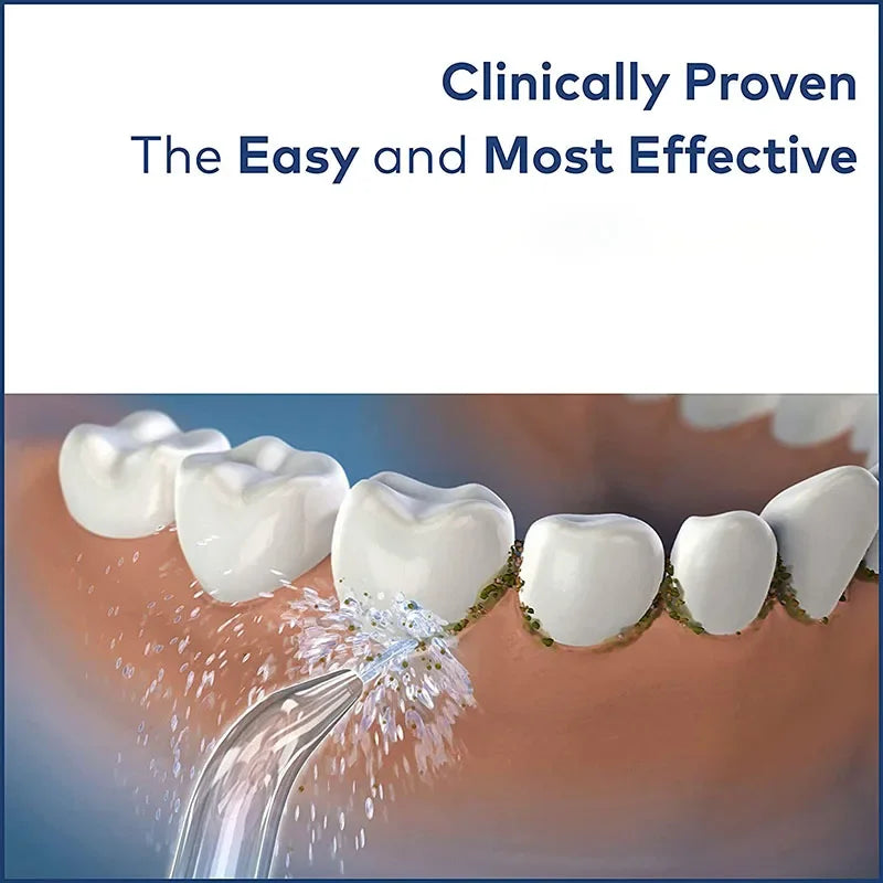 Oral Irrigator Water Flosser – Electric Teeth Cleaner with 7 Nozzles for Whitening, Dental Calculus & Braces Care