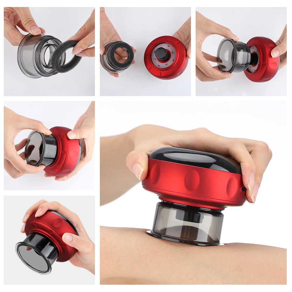 Smart Electric Vacuum Cupping Massager – Heating Suction Cup Device for Body, Back, Neck & Arms
