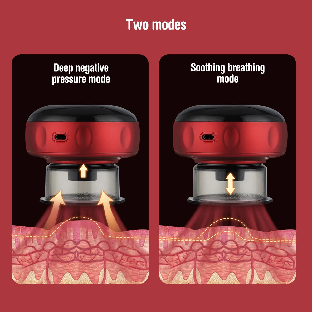 Smart Electric Vacuum Cupping Massager – Heating Suction Cup Device for Body, Back, Neck & Arms