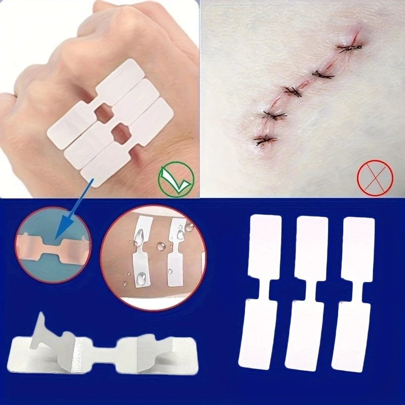 5PCS Outdoor Disposable Wound Adhesive Suture Patch & First Aid Bandage