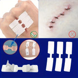 5PCS Outdoor Disposable Wound Adhesive Suture Patch & First Aid Bandage