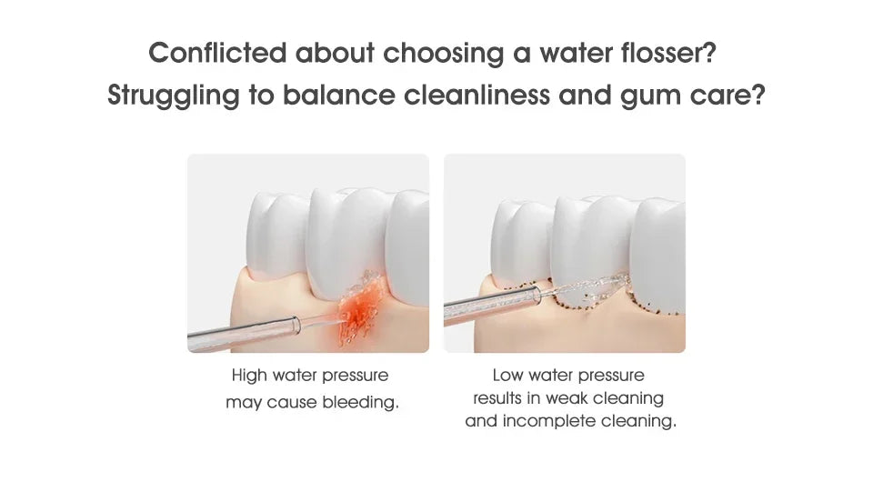 Xiaomi Mijia Portable Oral Irrigator 2 – USB Rechargeable Water Flosser (200 ml, 4 Modes, 4 Nozzles)