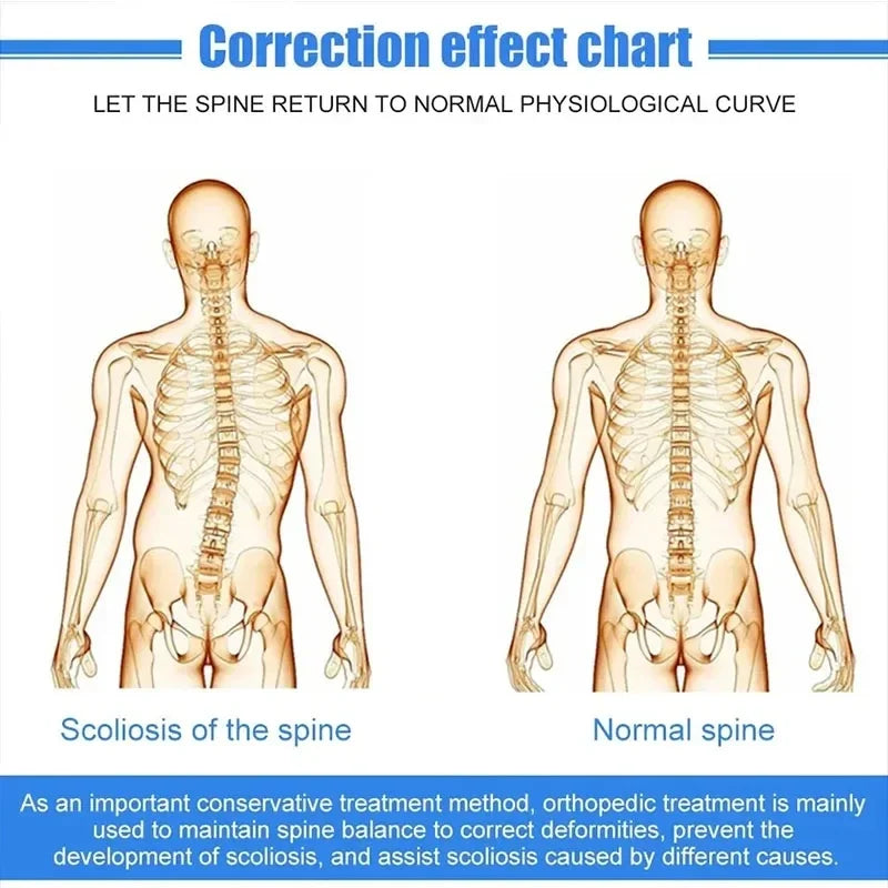 Adjustable Aluminium Spinal Brace – Breathable Back Straightener for Scoliosis Support (Kids & Adults)
