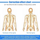 Adjustable Aluminium Spinal Brace – Breathable Back Straightener for Scoliosis Support (Kids & Adults)