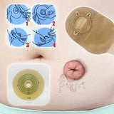 Open Clip Ostomy Bags – Two-Piece Drainable Colostomy & Ileostomy Pouches with Hoop & Loop Closure for Stoma Care