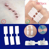 5PCS Outdoor Disposable Wound Adhesive Suture Patch & First Aid Bandage