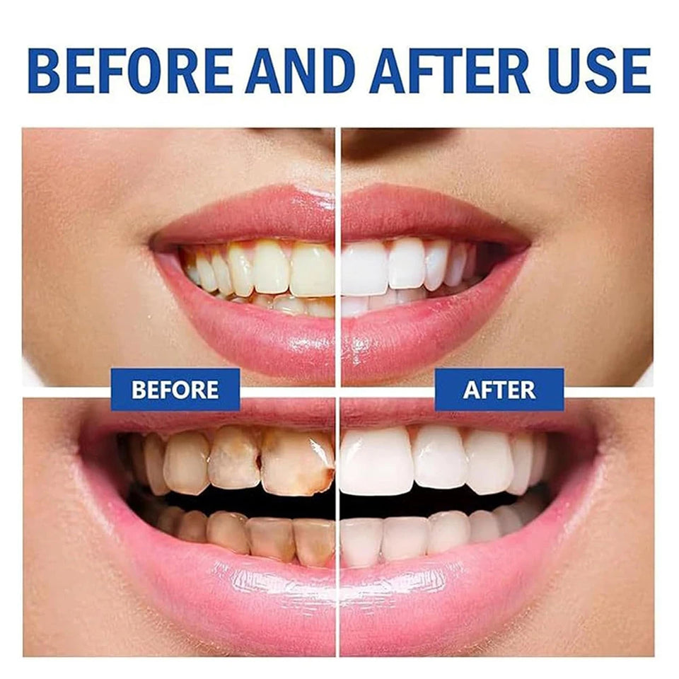 Hydroxyapatite Whitening Toothpaste – 120g Gentle Mint Stain Removal & Breath Freshening Oral Care