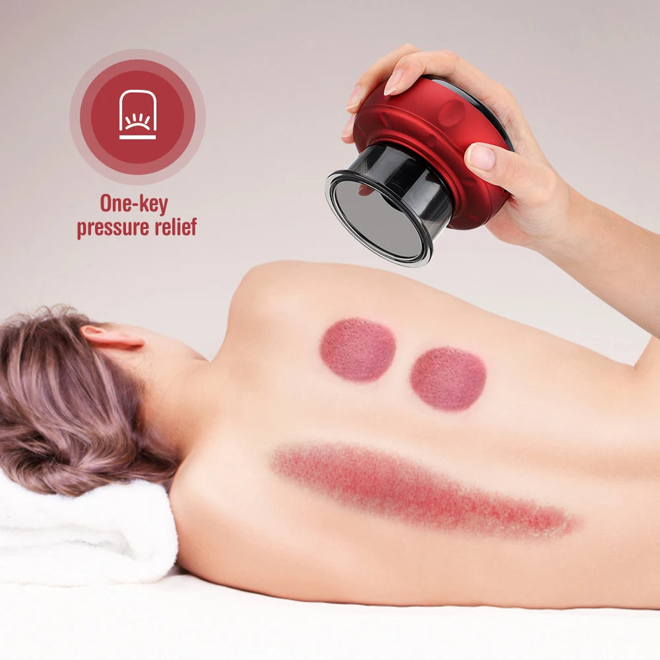 Smart Electric Vacuum Cupping Massager – Heating Suction Cup Device for Body, Back, Neck & Arms