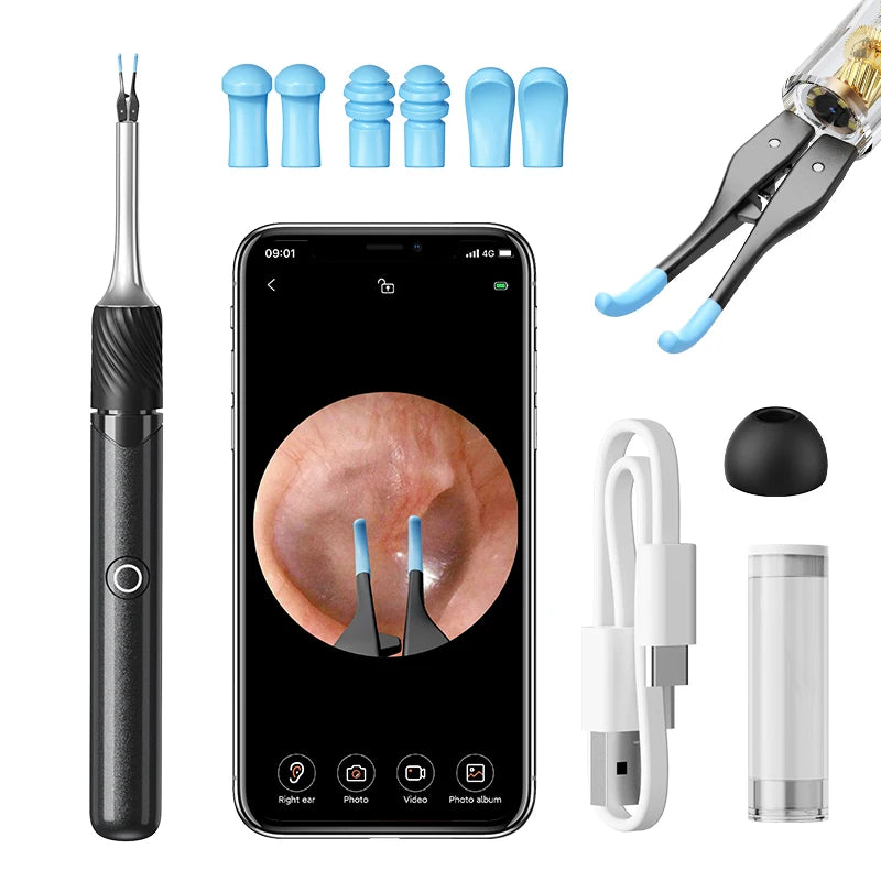 Visual Ear Cleaner with 12MP Camera – Ear Wax Removal Tool with Tweezers, Ear Pick & 6 Ear Spoons