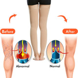 1 Pair Open Toe Thigh High Compression Stockings with Silicone Band – 20-30mmHg Graduated Support for Varicose Veins