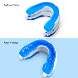 Silicone Anti-Snore Mouth Guard – Sleep Aid for Snoring, Bruxism & Sleep Apnea Relief