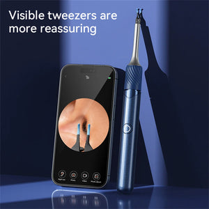 Visual Ear Cleaner with 12MP Camera – Ear Wax Removal Tool with Tweezers, Ear Pick & 6 Ear Spoons
