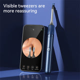 Visual Ear Cleaner with 12MP Camera – Ear Wax Removal Tool with Tweezers, Ear Pick & 6 Ear Spoons