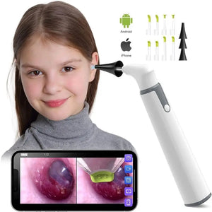 WiFi Digital Otoscope 3.9mm Ear Camera for iPhone & Android – Ear Wax Removal & Inspection Tool