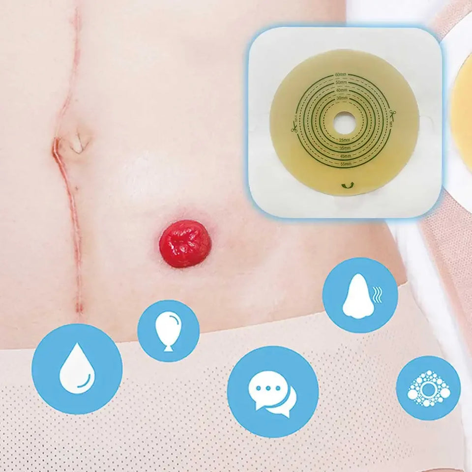 Open Clip Ostomy Bags – Two-Piece Drainable Colostomy & Ileostomy Pouches with Hoop & Loop Closure for Stoma Care