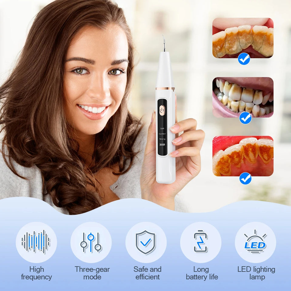 Ultrasonic Dental Scaler – Electric Teeth Cleaner & Tartar Remover for Plaque and Calculus Removal