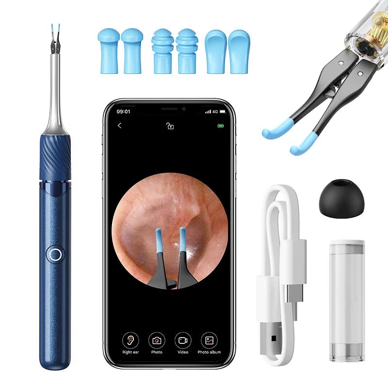 Visual Ear Cleaner with 12MP Camera – Ear Wax Removal Tool with Tweezers, Ear Pick & 6 Ear Spoons
