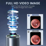 WiFi Digital Otoscope 3.9mm Ear Camera for iPhone & Android – Ear Wax Removal & Inspection Tool
