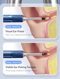 Visual Ear Cleaner with 12MP Camera – Ear Wax Removal Tool with Tweezers, Ear Pick & 6 Ear Spoons