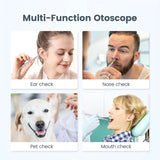 Digital Otoscope 1080P Ear Camera with 4.5" Screen, 3.9mm Lens, 6 LED Lights & 32GB Storage