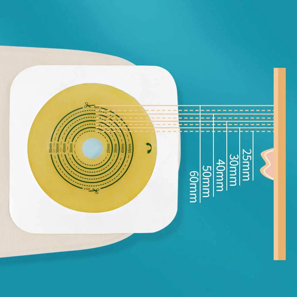 Open Clip Ostomy Bags – Two-Piece Drainable Colostomy & Ileostomy Pouches with Hoop & Loop Closure for Stoma Care