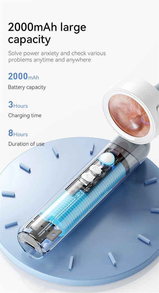 Wireless Visual Ear Camera – 1080P HD Endoscope with 1.38'' IPS Screen, Ear Wax Removal & Inspection Tool