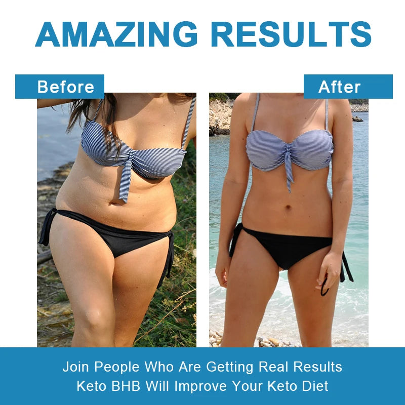 BHB Keto Gummies for Weight Loss – Slimming Support for Men & Women, Body Shape Management & Detox