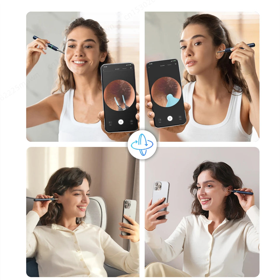 Bebird Note5 Smart Visual Ear Cleaner with Camera & Precision Tweezers – Mini Otoscope Earpick