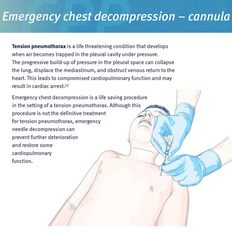 Sanke Rescue Pneumothorax Decompression Needle – 50G Chest Catheter for Trauma & First Aid IFAK Kits