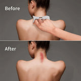 Stainless Steel Gua Sha Massage Tools Muscle Scraper Tool,Graston Tool Set for myofascial Release,Scar Tissue Massager for Back