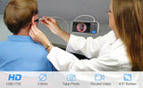 Digital Otoscope 1080P Ear Camera with 4.5" Screen, 3.9mm Lens, 6 LED Lights & 32GB Storage