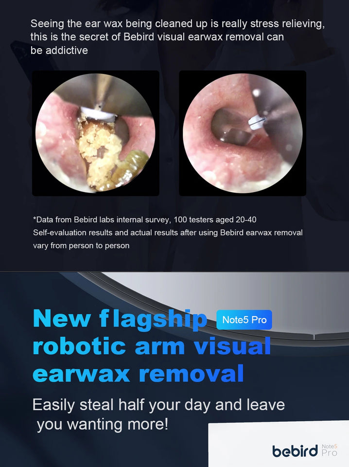 Bebird Note5 Smart Visual Ear Cleaner with Camera & Precision Tweezers – Mini Otoscope Earpick