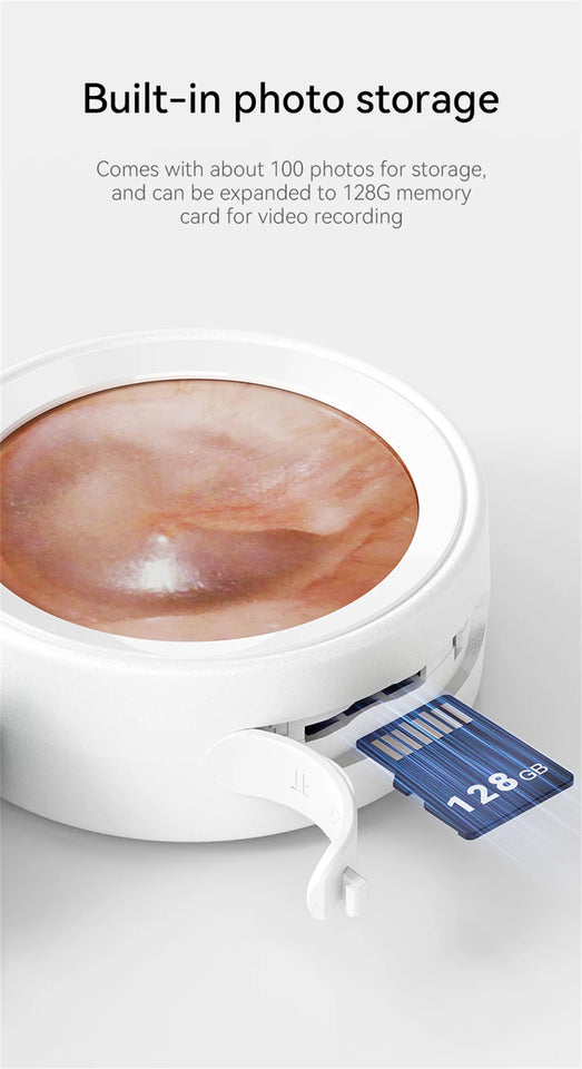 Wireless Visual Ear Camera – 1080P HD Endoscope with 1.38'' IPS Screen, Ear Wax Removal & Inspection Tool