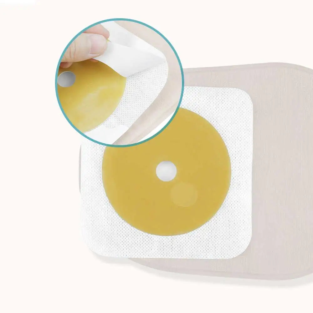 Open Clip Ostomy Bags – Two-Piece Drainable Colostomy & Ileostomy Pouches with Hoop & Loop Closure for Stoma Care
