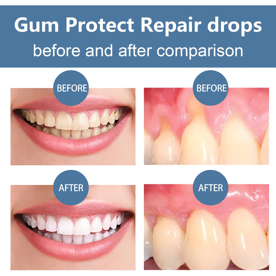 Rapid Repair Gum Serum – Tooth Sensitivity Relief & Dental Damage Repair Drops