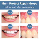 Rapid Repair Gum Serum – Tooth Sensitivity Relief & Dental Damage Repair Drops