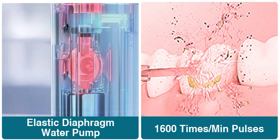 Portable High-Pressure Water Flosser & Oral Irrigator for Teeth