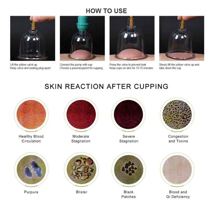 6or24  Pieces Suction Cups Massage Vacuum Cupping Body Massager Plastic Vacuum Suction Therapy Cupping Set Cans for Massage