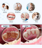 Schoben Ultrasonic Dental Scaler – Electric Tooth Cleaner for Tartar, Plaque & Stain Removal