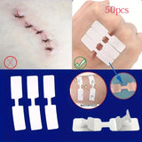 5PCS Outdoor Disposable Wound Adhesive Suture Patch & First Aid Bandage