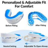 Silicone Anti-Snore Mouth Guard – Sleep Aid for Snoring, Bruxism & Sleep Apnea Relief
