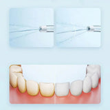 Xiaomi Mijia MEO703 Portable Oral Irrigator F300 – Electric Water Flosser with 240ml Tank, 4 Modes, IPX7 Waterproof