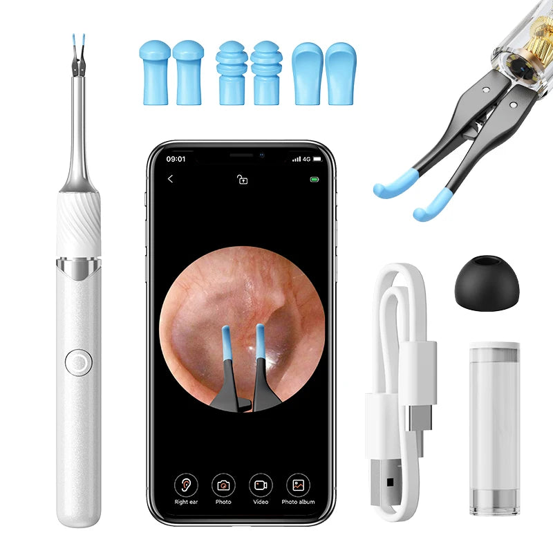 Visual Ear Cleaner with 12MP Camera – Ear Wax Removal Tool with Tweezers, Ear Pick & 6 Ear Spoons