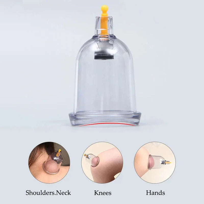 12/20/24 Cans Vacuum Acupuncture Cupping Anti-cellulite Physiotherapy Traditional Chinese Medicine Suction Cup Massage Therapy