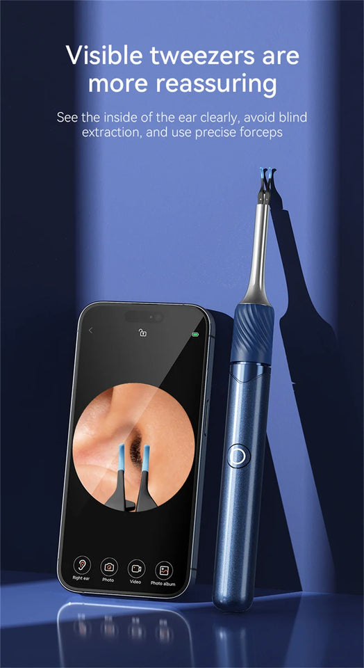 Visual Ear Cleaner with 12MP Camera – Ear Wax Removal Tool with Tweezers, Ear Pick & 6 Ear Spoons