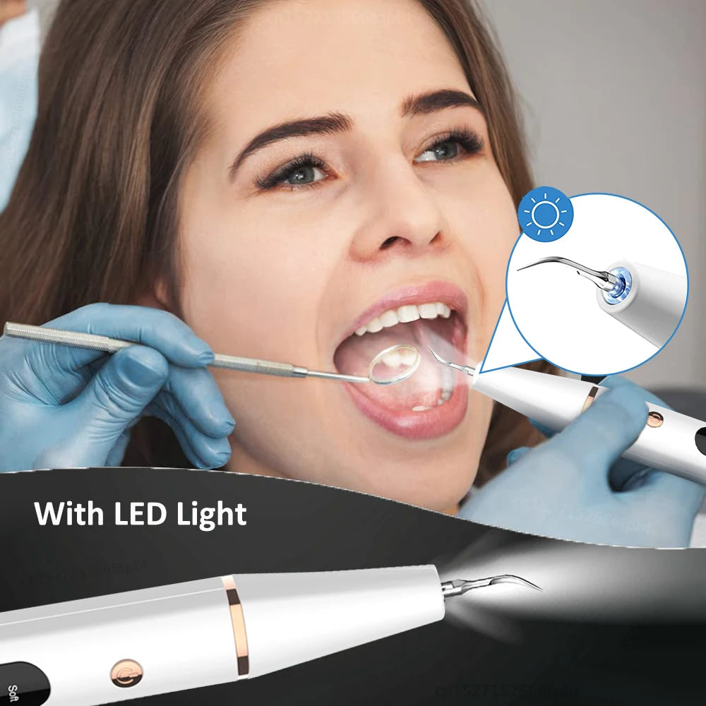 Ultrasonic Dental Calculus Scaler – Electric Tartar & Plaque Remover for Teeth Cleaning and Stain Elimination
