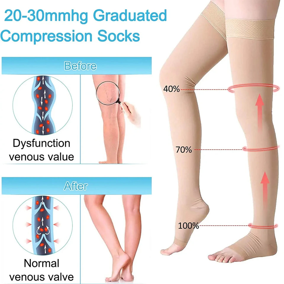 1 Pair Open Toe Thigh High Compression Stockings with Silicone Band – 20-30mmHg Graduated Support for Varicose Veins