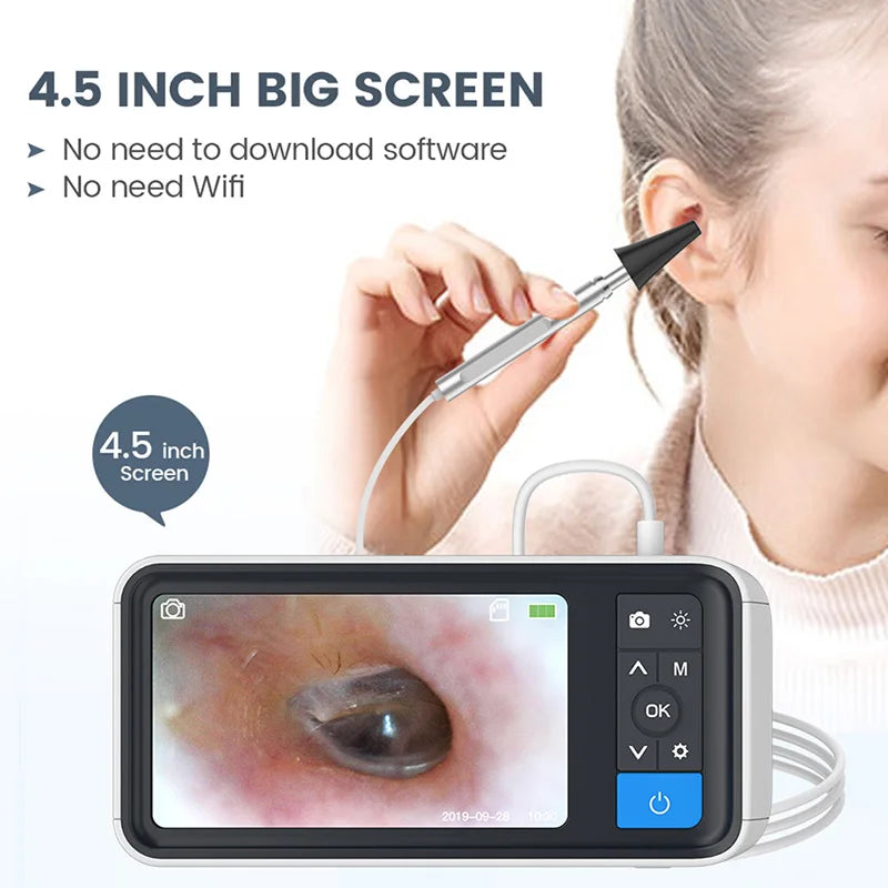 Digital Otoscope 1080P Ear Camera with 4.5" Screen, 3.9mm Lens, 6 LED Lights & 32GB Storage