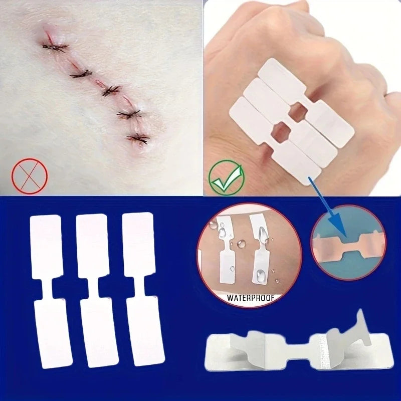 5PCS Outdoor Disposable Wound Adhesive Suture Patch & First Aid Bandage