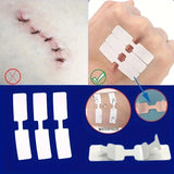 5PCS Outdoor Disposable Wound Adhesive Suture Patch & First Aid Bandage